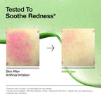 Anua Korean skincare serum for hyperpigmentation, UAE. Before and after showing redness reduction with a green background