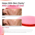 Anua dark spot corrector serum ingredients close-up.
Promotional graphic for a skincare serum claiming it helps with skin clarity after 2 weeks of use. The image features a close-up before-and-after comparison of a person's cheek with a dotted circle highlighting smoother skin, alongside a pink liquid gel sample in a clear dropper container.
